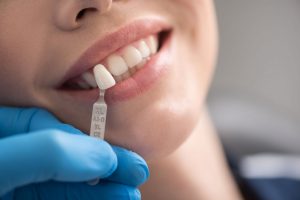 after placement of dental implants frisco TX
