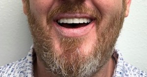 after all on 4 full smile