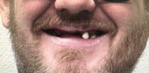 before all on 4 smile